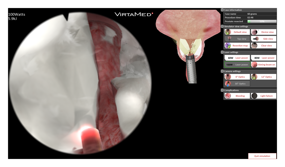 VirtaMed UroS — prikaz HoLEP 60 g u simulatoru